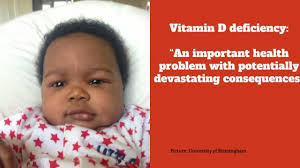 Nov 27, 2020 · vitamin d can also have huge benefits for muscle function, cognition and falling. Here S Why Vitamin D Supplements Are Essential To Darker Skinned Babies