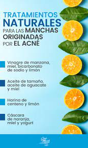Pin En Remedios Naturales