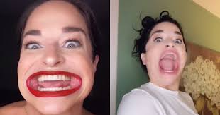 Necessary cookies are absolutely essential for the website to function properly. Woman With Biggest Mouth Turns Into A Tiktok Sensation
