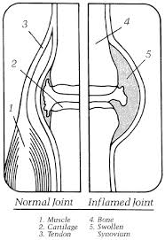 Image result for normal finger Joint cartilage arterial circulation