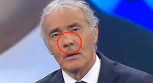 Info su massimo giletti biografia filmografia discografia video foto citazioni curiosità frasi celebri news carriera. Massimo Giletti Volto Tumefatto In Diretta Ho Il Naso Rotto Mistero A Non E L Arena