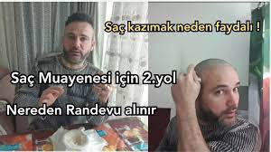 Lokman Hekimin Sac Cikarma Formulu