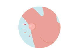 For example, lumps that form in the armpit are. 9 Causes For A Painless Lump Under The Armpit Buoy