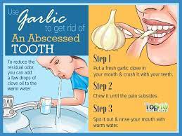 Pin On Natural Remedies