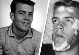 Sixty years ago, 17-year-old Randy Gardner broke a Guinness world record by  staying awake for 11 consecutive days. His experiment is one of the most  well-documented cases of sleep deprivation.