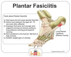 Pin On Plantar Fasciitis