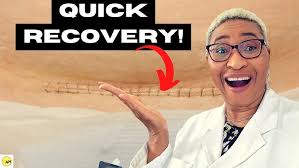 Should one worry if hole in Cesarean incision is seen after delivery?