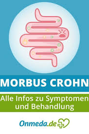 Morbus Crohn Therapie Lebenserwartung Onmeda De Morbus Crohn Bauchschmerzen Standig Durchfall