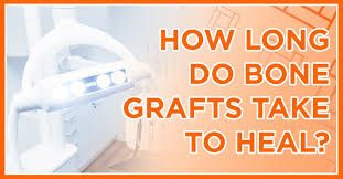 How Long Does It Take To Recover From A Bone Graft In The Mouth