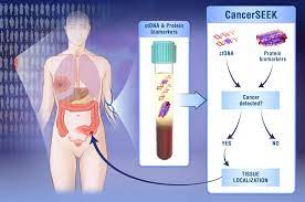 This early detection system helps immensely and a simple blood test that can detect more than 50 types of cancer before any clinical signs or symptoms. Novel Blood Test Detects Eight Cancers European Biotechnology