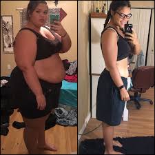 Pin On Before After