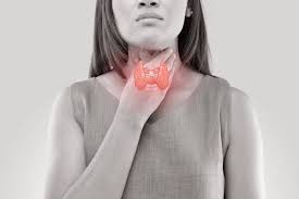 Đa số ung thư tuyến giáp là carcinôm biệt hoá tốt, tiến triển âm thầm, giai đoạn ẩn bệnh kéo dài, điều trị chính yếu là phẫu thuật. Khong Pháº£i DÆ°a Muá»'i 4 Thá»© Nay Má»›i La Nguyen Nhan Gay Ra Ung ThÆ° Tuyáº¿n Giap
