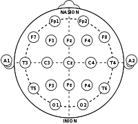 脳波 - Wikipedia