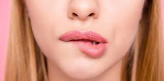 Lippen sind die häufigste und auffälligste lokalisation von herpetischen eruptionen. Ein Lebenslanger Begleiter Der Lippenherpes Herpes Labialis Pta Digital