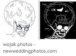 Wojak's brain variations have collided now with another meme. X Ray Tumor Brain Wojak Photos Newweddingphotoscom Brain Meme On Me Me