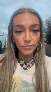 My lip filler results! 👄💉 First video- directly before. Second video- the  day after. Third video- 2 weeks after. Thank you to Nectar Body Solutions  for achieving my perfect results! Don't forget