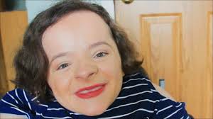 Michaela is diagnosed with Osteogenesis Imperfecta. At 21 years old she is  31 inches tall and has experienced about 100 fractures. We filmed this  interview the day before Michaela underwent a surgery