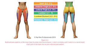 Low back pain chart 20x26. Hip Pain Explained Including Structures Anatomy Of The Hip And Pelvis