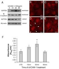 Soluble VCAM-1 Alters Lipid Phosphatase Activity in Epicardial Mesothelial  Cells: Implications for Lipid Signaling During Epicardial Formation