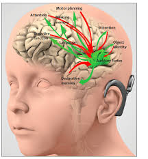 What are the central consequences of hearing loss?