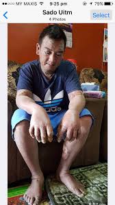 Setiap segmen memiliki garis yang terang dan biasa disebut dengan ocelli. Yap On Twitter Cuti2 Ni Sapa Yg Nk Ke Pantai Hati2 Baru2 Ni Di Port Dickson Pd Waterfront If Not Mistaken Ade Org Dah Jumpa Bristle Worm Atau Ulat Bulu Laut Really Harmful