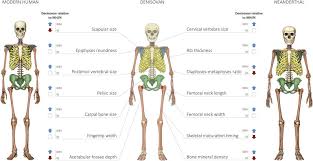 This image shows a young female denisovan, reconstructed based on dna. Reconstructing Denisovan Anatomy Using Dna Methylation Maps Sciencedirect