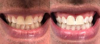 At aesthetic dentistry of bernardsville, our talented dental team has the technology, training, and experience to provide you with quality dental care that . Aesthetic Dentistry Of Bernardsville Patti Swaintek Lamb Dmd Home Facebook