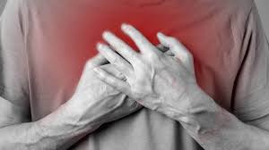 Image result for Angina Pectoris