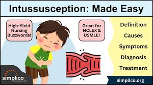 Image result for Intussusception