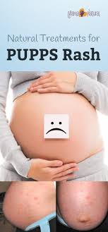 Pin On Natural Pregnancy Childbirth