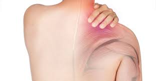 Image result for Polymyositis