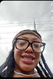 Get Yo Teeth Done Sis 🦷😬🪥