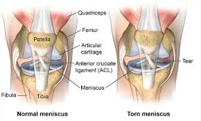 Image result for Menisorus