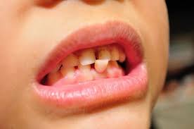 Another way to getting a tooth to come out naturally is by offering your child foods that will put stress on the loose tooth. Pulling Out Your Child S Loose Baby Tooth Loose Tooth Loose Teeth Kids Loose Tooth Removal