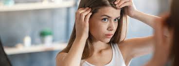 Pcos hair loss also known as androgenic alopecia or female pattern hair loss can be quite common. Everything You Need To Know About Pcos Hair Loss Strut Blog