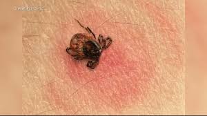 Protecting Yourself From Ticks And Lyme Disease During Warm Summer Months 6abc Philadelphia