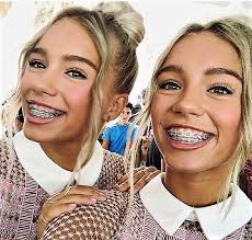 Pin On Girls In Braces