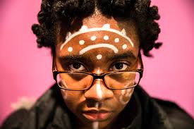 Globe staff photos of the month, February 2018