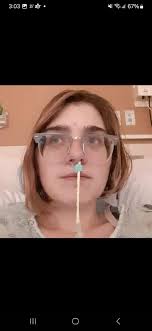 Experiences with g tube switched to g/j tube?