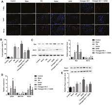 For your convenience mconvert has online euro to litecoin (eur vs ltc) history chart and a table of popular currency pairs with their latest exchange rates for 01/01/2021. Changqin No 1 Inhibits Neuronal Apoptosis Via Suppressing Gas5 Expression In A Traumatic Brain Injury Mice Model