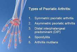 What are the 5 types of psoriatic arthritis. Psoriatic Arthritis Symptoms Treatment Images