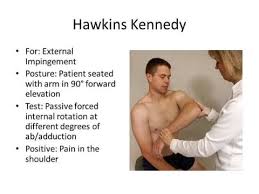 Image result for Hawkins Test
