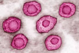 Acyclo vir 및 점안액을 사용하여 치료하였으며 2년간 재발 없이 안압은 1 2 mmhg , 교정시력은 0.5로. í—¤ë¥´íŽ˜ìŠ¤ì— ëŒ€í•œ ìƒˆë¡œìš´ ì•½ì„ ì—´ì—ˆìŠµë‹ˆë‹¤ Iliveì˜ ê±´ê°•ì— ëŒ€í•œ ìœ ëŠ¥í•œ ì •ë³´