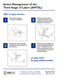 Image result for Active Management of Labor