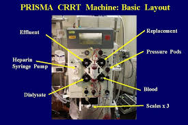 The ideal machine for crrt: Current Technology For Crrt Dr Peter Skippen Picu