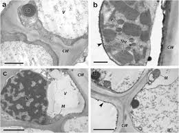 We did not find results for: Method For Hydrophytic Plant Sample Preparation For Light And Electron Microscopy Studies On Phragmites Australis Cav Sciencedirect