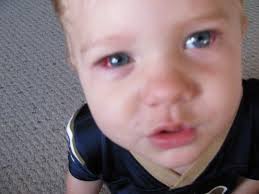 Hoods Hopeful -Jackson's Journey with Hemimegalencephaly