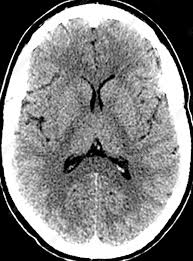 Image result for CT Head