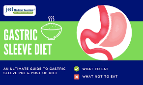 You need to discuss this with your surgeon as there is often a s. Gastric Sleeve Diet An Ultimate Guide On Vsg Diet