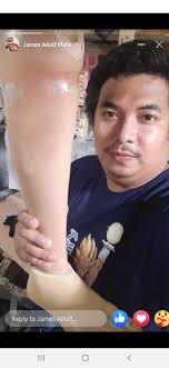 Below the knee prosthetic leg...